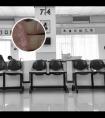 白癜风去医院挂什么科a