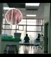 小孩脸上有白斑块的图片是什么原因呢