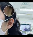 白癜风为什么要照紫外线vD3