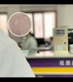 小儿面部白斑什么原因引起的图片