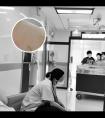 他克莫司浓度正常范围表