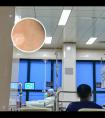 卡帕三醇倍他米松凝胶什么作用
