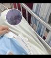 308激光治疗白癜风一般多久